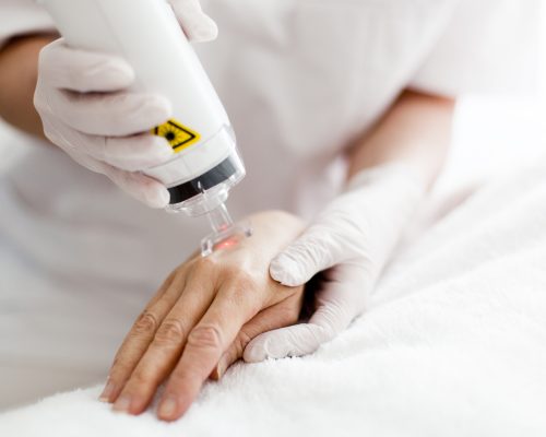 Photo of a patient getting Laser Skin treatment.