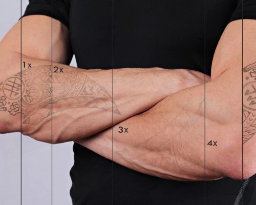 Laser tattoo removal before and after. Attractive Man with tattoo on his hand skin